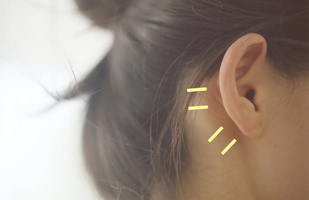 Emergency SelfCare Ear Wax Removal Kit Anglia Ear Care